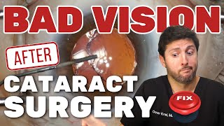 Poor Vision after Cataract Surgery - How we FIXED it