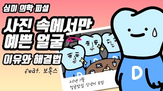 사진빨, 사진과 실물 다름, 의학적 관점에서 이유와 해결책 분석해보자(feat.보톡스, 미소, 비대칭)