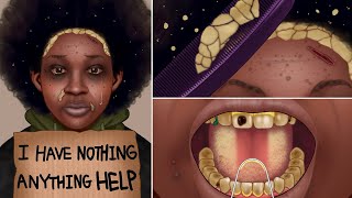 ASMR 노숙자 역대급 케어 애니메이션 2 | 10년 동안 방치된 더러운 이물질 관리 | Homeless Transformation Animation