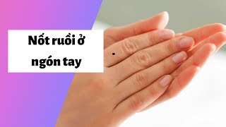 Xem bói nốt ruồi ở ngón tay Trái, Phải ở Nam, Nữ có ý nghĩa gì?