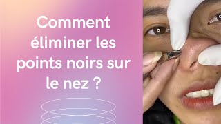 Comment enlever les points noirs avec un tire-comédon ?