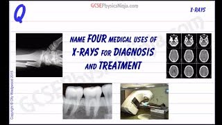 Medical Uses of X-Rays - GCSE Physics