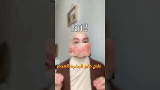 Part 2 معالجة حاجز البشرة المتضرر #skincare #reels