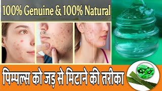 How To Get Rid Of Acne | Diet Plan For Acne Prone Skin | How To Get Rid Of Pimples | Acne TREATMENT