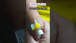 تركيب كانيولا للأطفال Cannula insertion for children