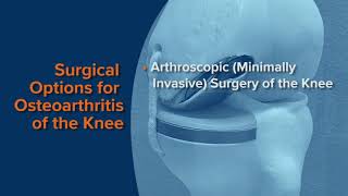 Treatments for Knee and Hip Arthritis | Brett Gilbert, MD