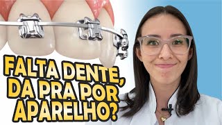 Quero colocar aparelho, mas perdi alguns dentes. E agora?