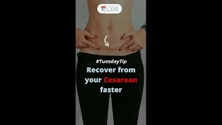 Post Cesarean Recovery Tips With USSH | Upasani Super Speciality Hospital | Mulund | Mumbai