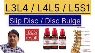 Homeopathic medicine -- L3L4 / L4L5 / L5S1 Disc Bulge / Slip disc / Herniated disc ka jad se ilaj