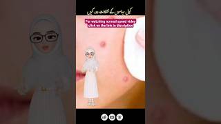 chehry k dagh dhaby| dark spots on face| Free Ramedies