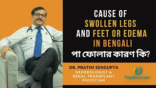 Cause of swollen legs or feet | পা ফোলার কারণ কি? | Edema in Bengali | Kidney disease swollen feet