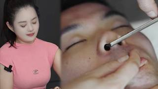 💈ASMR | Remove dead skin and whiskers from a man's face. 🪒 Facial skin care!