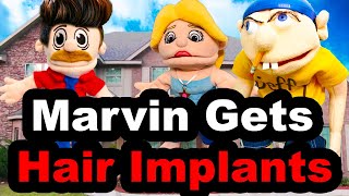 SML YTP: Marvin Gets Hair Implants