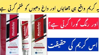 Skin Whitening Night Cream Review in urdu hindi | Mandelac Cream