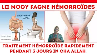 LII MOOY FAGNE Hémorroïdes TRAITEMENT HÉMORROÏDE RAPIDEMENT PENDANT 3 JOURS IN CHA ALLAH S EL HADJI