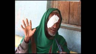 ATCP Trachoma documentary Ethiopia