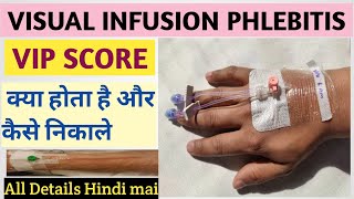 WHAT IS PHLEBITIS AND HOW TO CALCULATE VIP SCORE || THROMBOPHLEBITIS || CANNULA