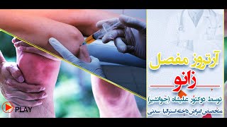 مرض آرتروز مفصل زانو چیست؟ توسط:داکتر علیشاه-جوانشیر،متخصص امراض داخله سدنی-آسترالیا