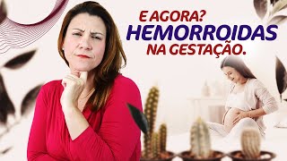 Grávida Com Hemorroida Pode Ter Parto Normal? - Amor de Doula com Elisa Blanco