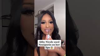 Abby Nicole used Neosporin on her lips 😱 #abbynicole #lifehacks #liphacks #lipfillers #lipgloss