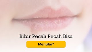 Bibir Pecah Pecah Bisa Menular?