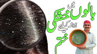 Balon Ki Khushki خُشکی (Sikri) Ka Ilaj - Sar Me Khushki "Hair Dandruff" Khatam Karne Ka Tarika