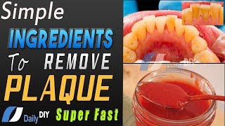 How To Remove Plaque From teeth | Simple Ingredients For Teeth Plaque Cleaning At Home