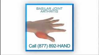 Hand Surgery Center Dr Steven Helgemo Basilar Joint Arthritis 30