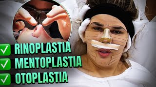 Confira COMO FICOU minha RINOPLASTIA, OTOPLASTIA e MENTOPLASTIA 😍