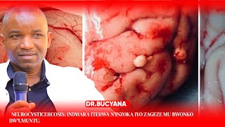 NEUROCYSTICERCOSIS: INDWARA ITERWA N'INZOKA IYO ZAGEZE MU BWONKO BW'UMUNTU.