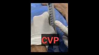 طريقه قياس CVP نسبه السوائل في الجسم central venous pressure