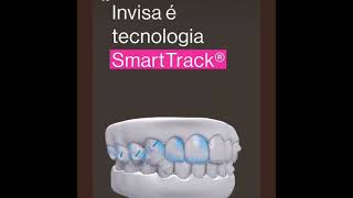 Transforme seu sorriso com mais conforto usando Invisalign Padrão Prada Odontologia