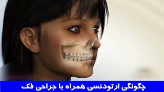 چگونگی ارتودنسی همراه جراحی فک|دکتر احسان ابویی مهریزی