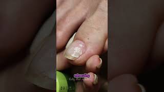 Mẹo làm nghề nail khi móng chân khách bị gãy #nails #thonail #lamnail #hocnail