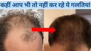 Baal jhadne se rokne ke upay | Hair fall mistakes