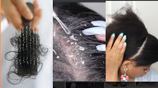 Niba ugira imvuvu nyinci, gupfuka umusatsi cyane, umusatsi udakura Reba iyi video. + GRWM wash n go