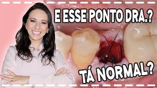 TIREI O DENTE E O PONTO ESTÁ ESTRANHO, SERÁ NORMAL? Dra. Jaque Akemi - Londrina-PR