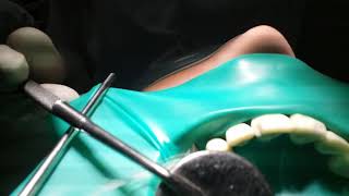 Dental Dam Use in a Mannequin