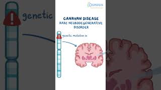 Canavan Disease