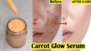 Carrot Glow Serum To Lighten Pigmentation,Spots,Scars & Freckles/Carrot Serum Homemade/Diy Serum