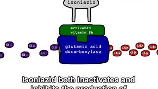 Isoniazid-induced Seizures