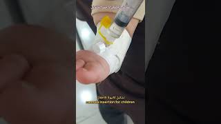 تشكيل كانيولا للأطفال Cannula insertion for children