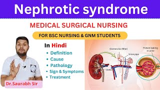 Nephrotic syndrome || medical surgical nursing || For Bsc Nursing and GNM and medical students