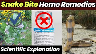 How To Treat A Snake Bite | Home Remedies हिंदी / Urdu