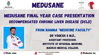 DCLD Case Discussion | General Medicine | Final Year MBBS | Dr Yogesh S M.D., | Medusane