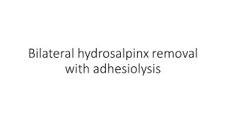 Bilateral hydrosalpinx removal with adhesiolysis by Dr Neena Singh