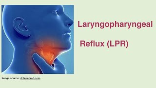 Laryngopharyngeal reflux, another type of acid reflux.