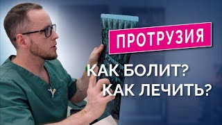 ПРОТРУЗИЯ в пояснице: как лечить? Прием пациента, разбор МРТ, тесты, лечение