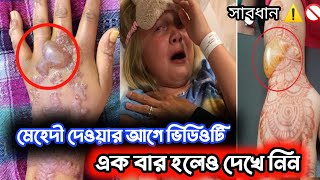 সাবধান ⚠️ মেহেদী থেকে ছরাচ্ছে ভয়ংকর রোগ | ক্ষতিকর মেহেদী থেকে সাবধান 😱😢