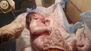 new born female baby came delivered with iscs baby clean with baby oil active baby strong cry ❣️